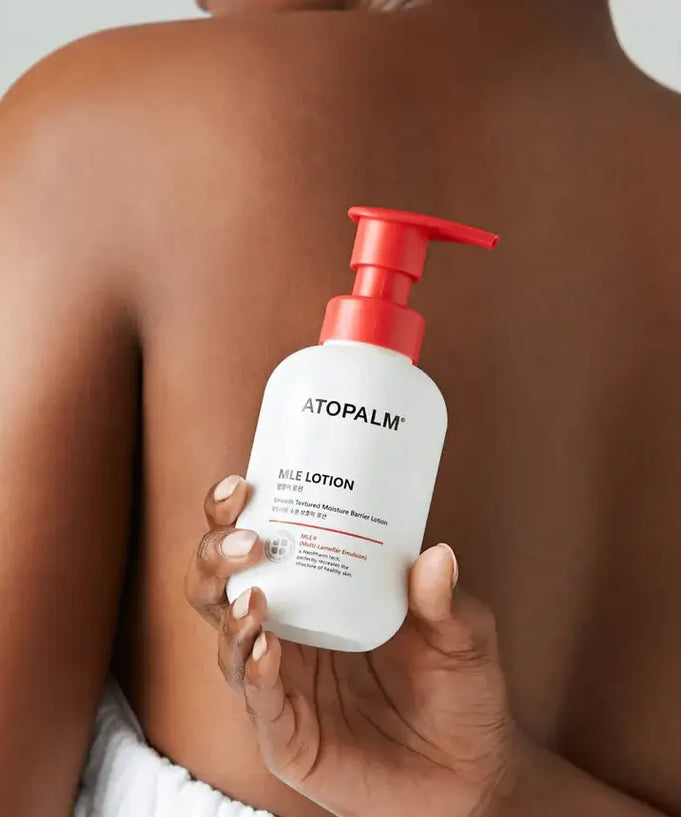 Person holding ATOPALM MLE Lotion 300ml bottle against their back
