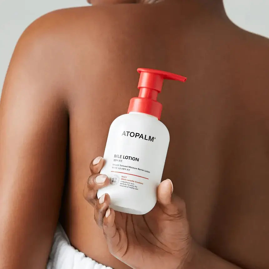 Person holding ATOPALM MLE Lotion 300ml bottle against their back